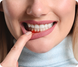 Diş Eti Hastalıkları